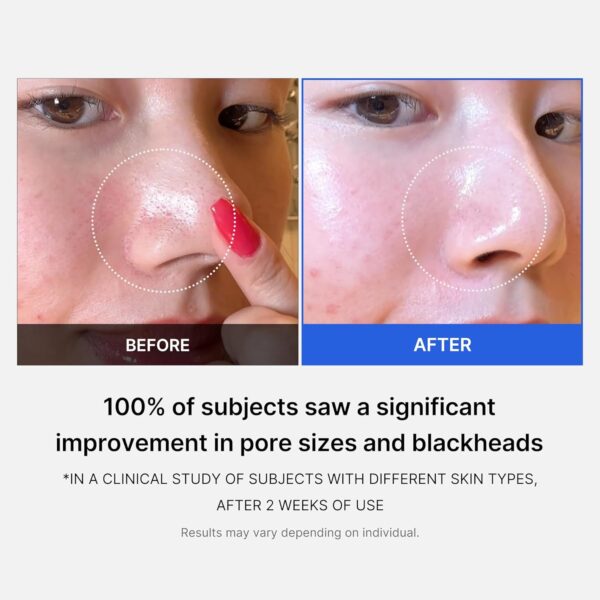 Limited time deal-51% Medicube Zero Pore Pads 2.0, Dual-Textured Facial Toner Pads for - Image 2