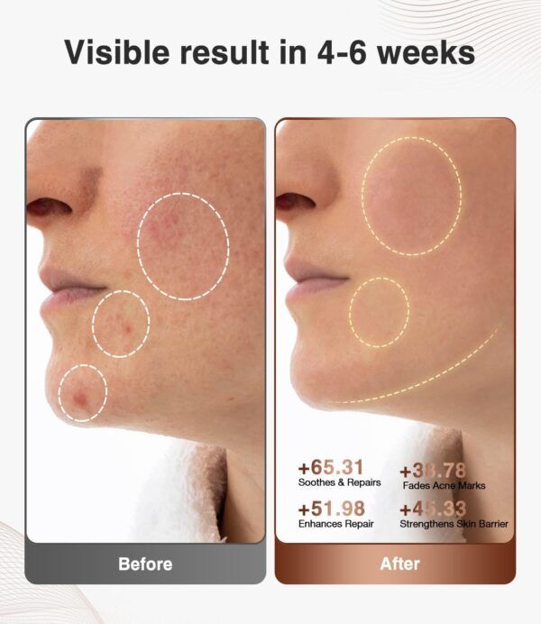 Big Spring Deal-58% off JOVS Red Light Therapy for Face, LED Light Therapy Beauty Device for Face, 4 - Image 3