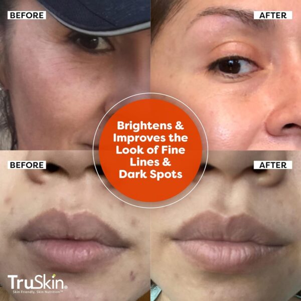 Limited time deal-56% off TruSkin Vitamin C Serum For Face – Anti Aging Formula with Vitamin C, Hyal - Image 3