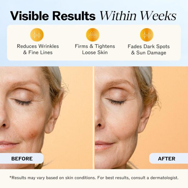 Limited time deal-40% off LilyAna Naturals Anti Aging Retinol Face Cream for Women – Wrinkle & Nec - Image 4